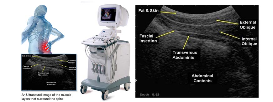 Real Time Ultrasound- Karur Physiotheraphy